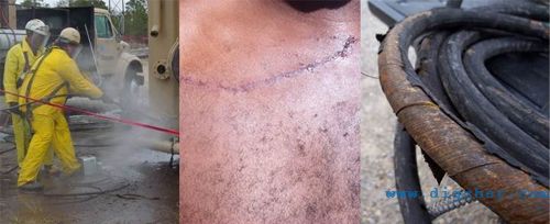 �߉���ϴ�C�����Б�(y��ng)ע��İ�ȫ���}